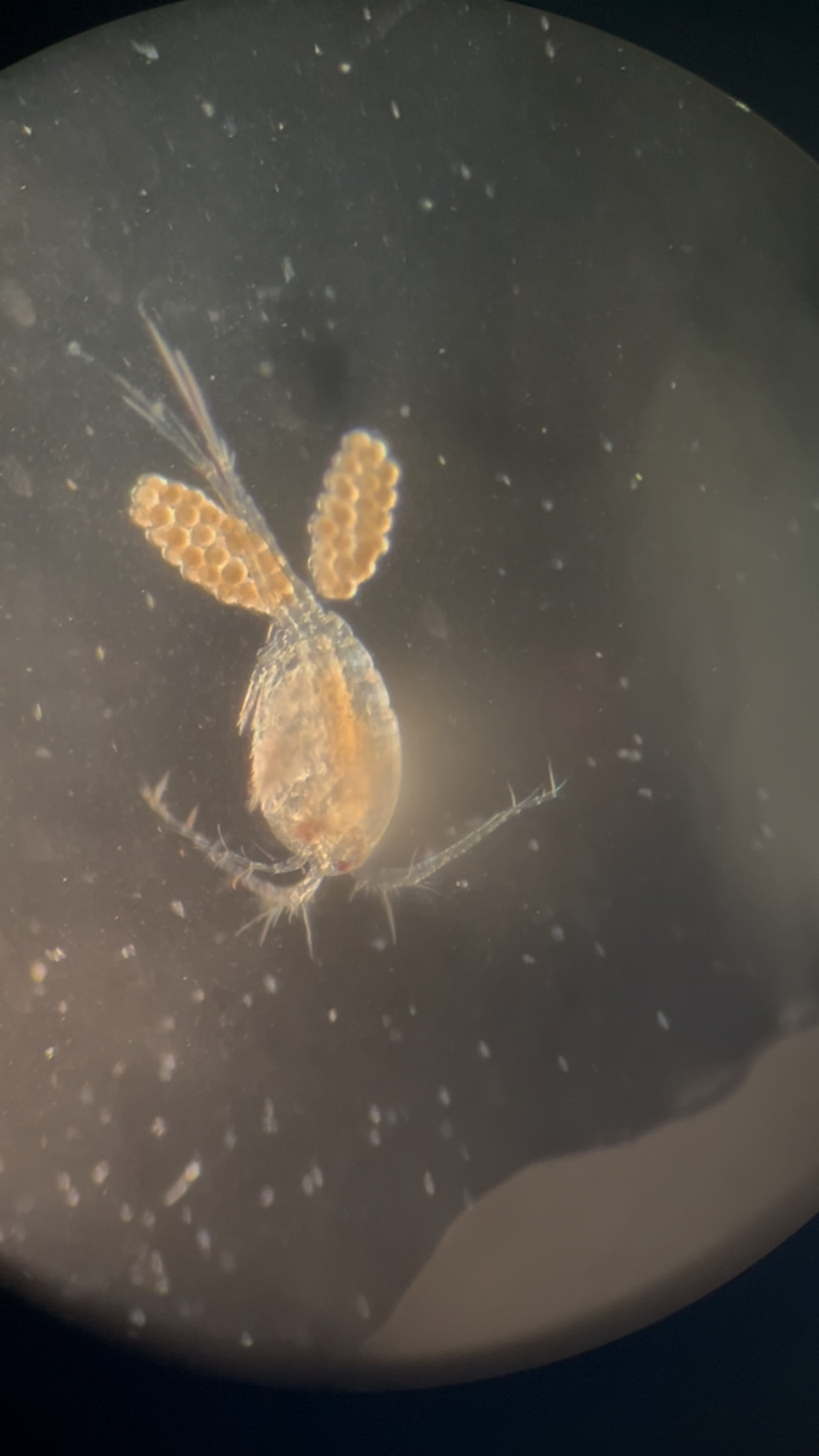 Live Instant Microbial Food Web Kit – Daphnia, Ostracods, Copepods + More